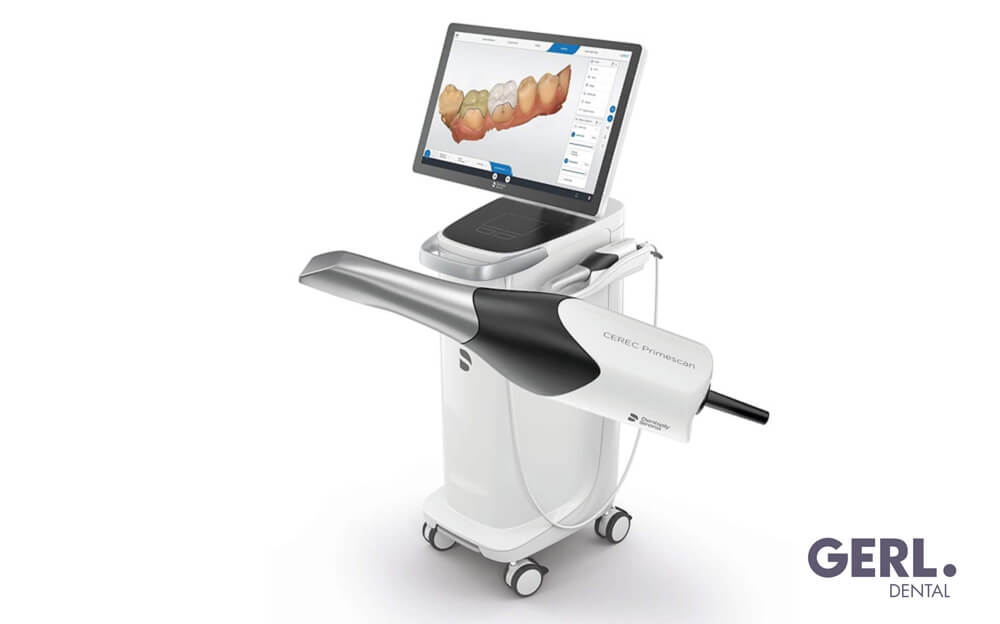 RW_Intraoralscan_1