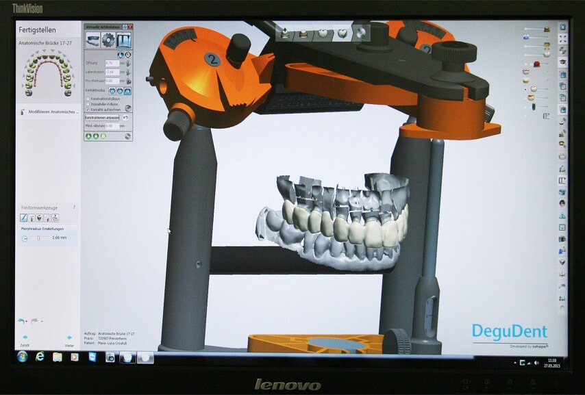 Riewenherm-Dentaltechnik-7