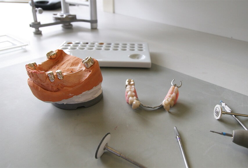 Riewenherm-Dentaltechnik-5